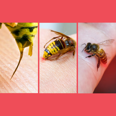 Difference between Bee, Wasp, and Hornet Stings