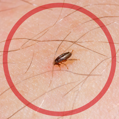 Flea Bites Treatments to Relieve Discomfort and Prevent Infection